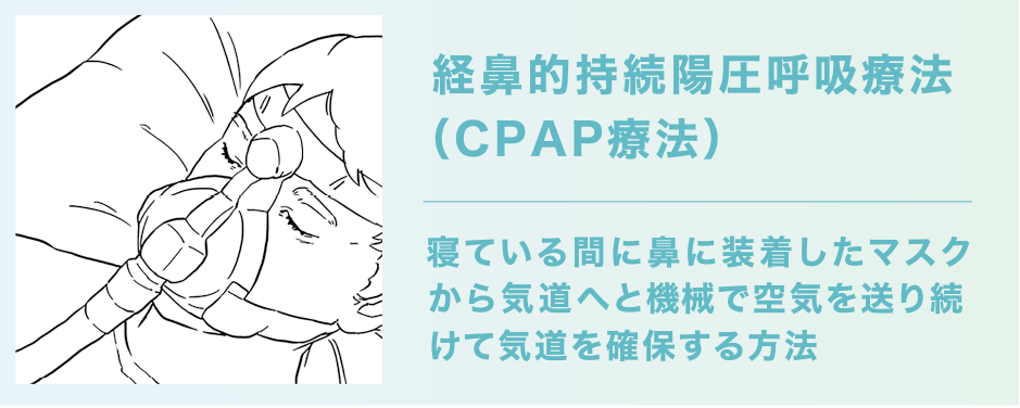 経鼻的持続陽圧呼吸療法（CPAP療法）